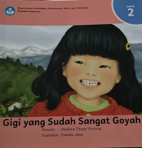 Image of Gigi yang Sudah Sangat Goyah